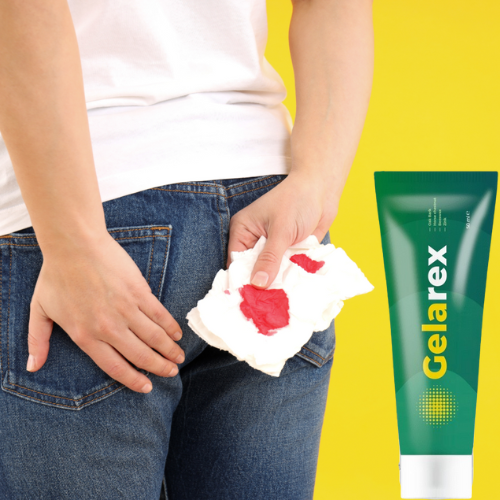 GELAREX IMG4